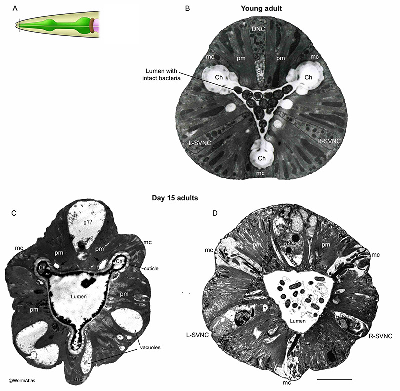 APhaFIG 6: Aging of the anterior pharynx