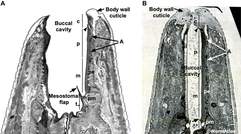 DPhaFIG 2: Buccal cavity in the dauer larva.