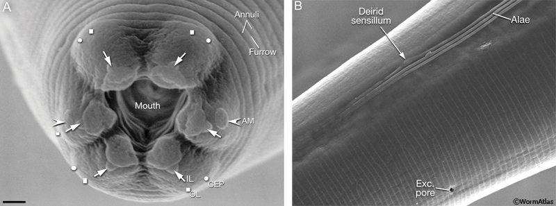 CutFIG 2 SEMs of adult C. elegans showing sensory sensila